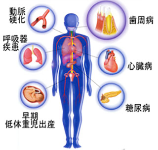 歯周病を放っておくとどうなるの