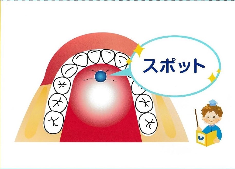 スポット_page-0001