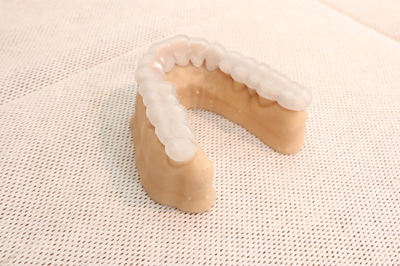 P5プリンターで作製したレジン模型とマウスピース