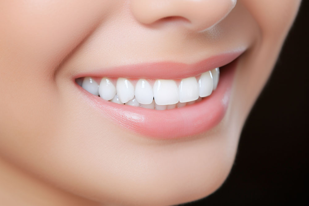 ホワイトニング