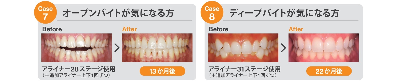23.トリミング済み_Invisalign_カウンセリングツール_院内用_ページ_2-4