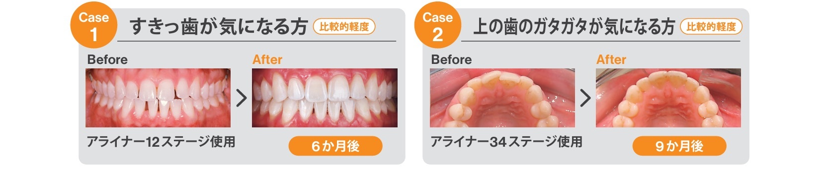 23.トリミング済み_Invisalign_カウンセリングツール_院内用_ページ_2-1