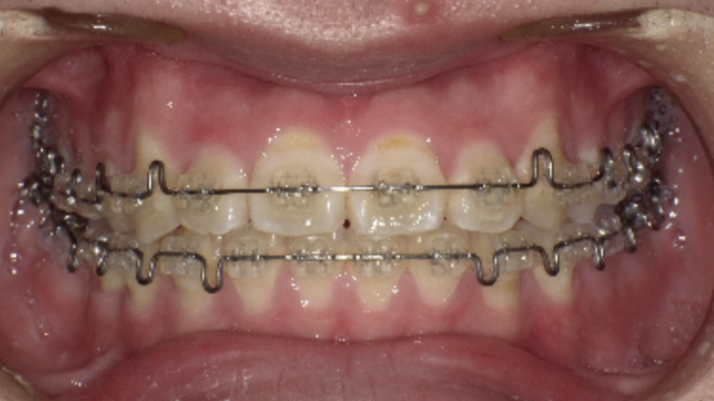 orthodontics-GEAWsystem