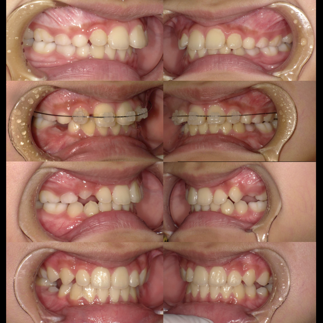 pediatric Orthodontics