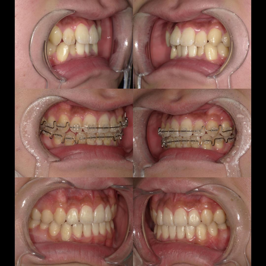 ortho before after