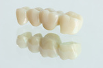 Molar teeth zirconia_323021693