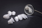 ceramic teeth_185557586