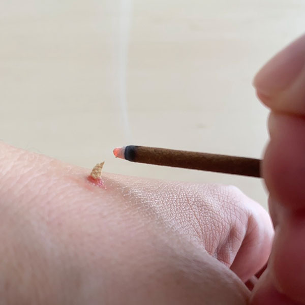 灸|レディース鍼灸ゆりかご-1