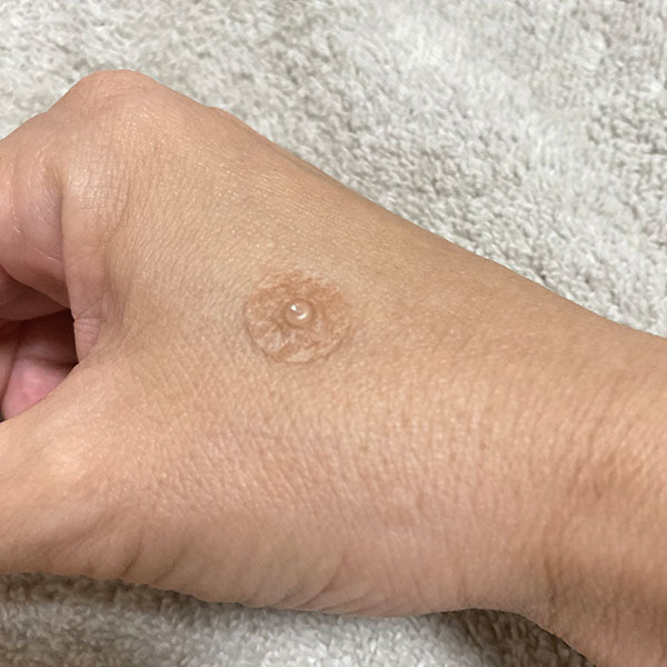 灸|レディース鍼灸ゆりかご-5