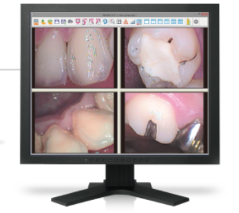 camera_monitor