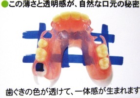 denture1