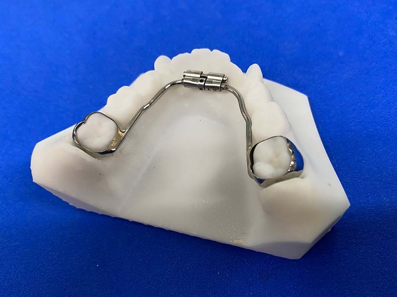 使用する装置の例1|機能矯正とは