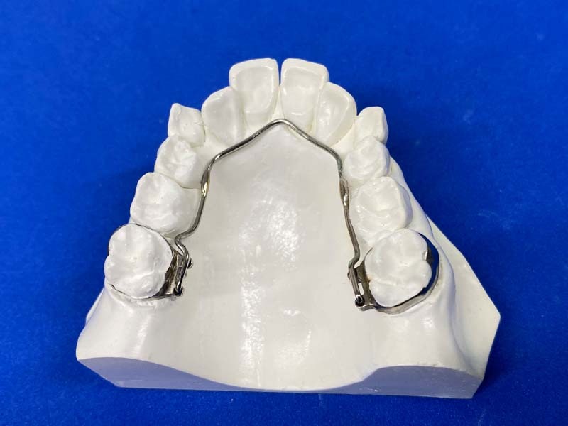 使用する装置の例3|機能矯正とは