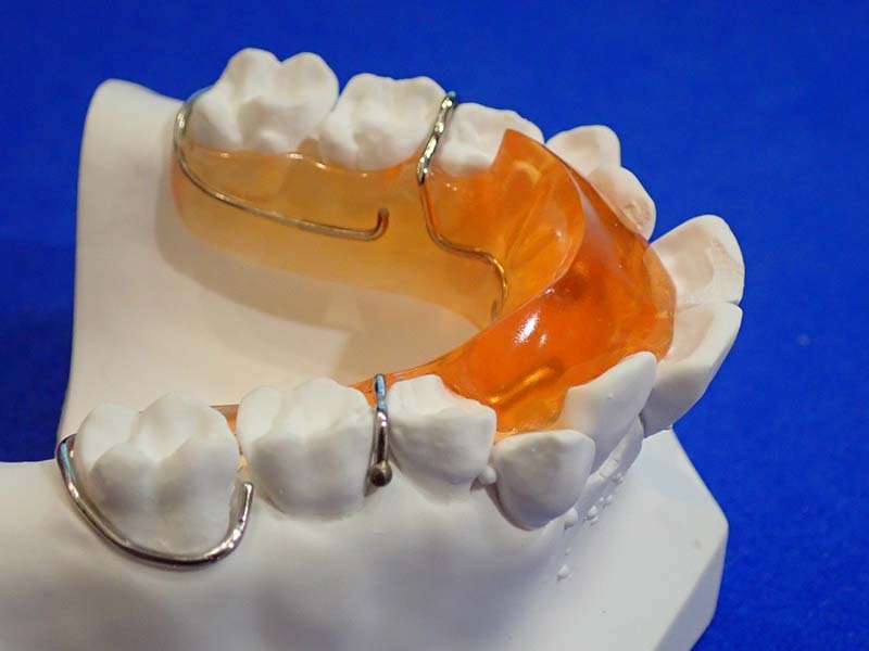 使用する装置の例4|機能矯正とは