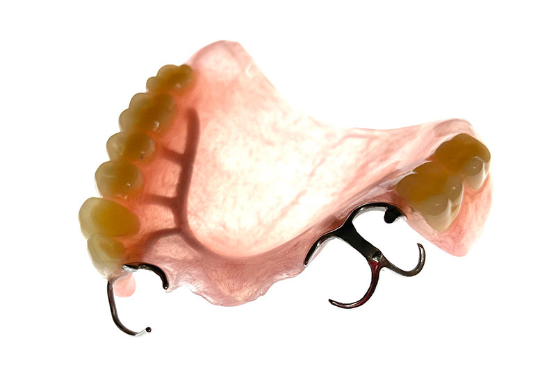 14-2_保険診療の入れ歯