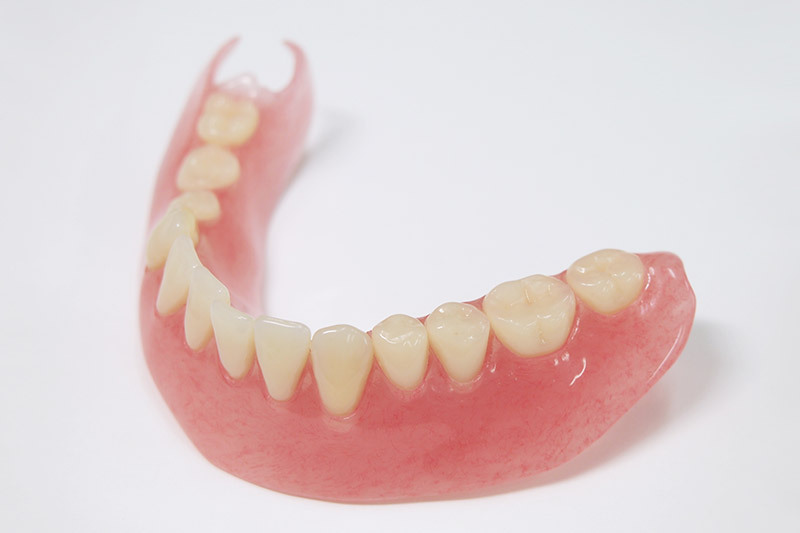 14-3_自由診療の入れ歯