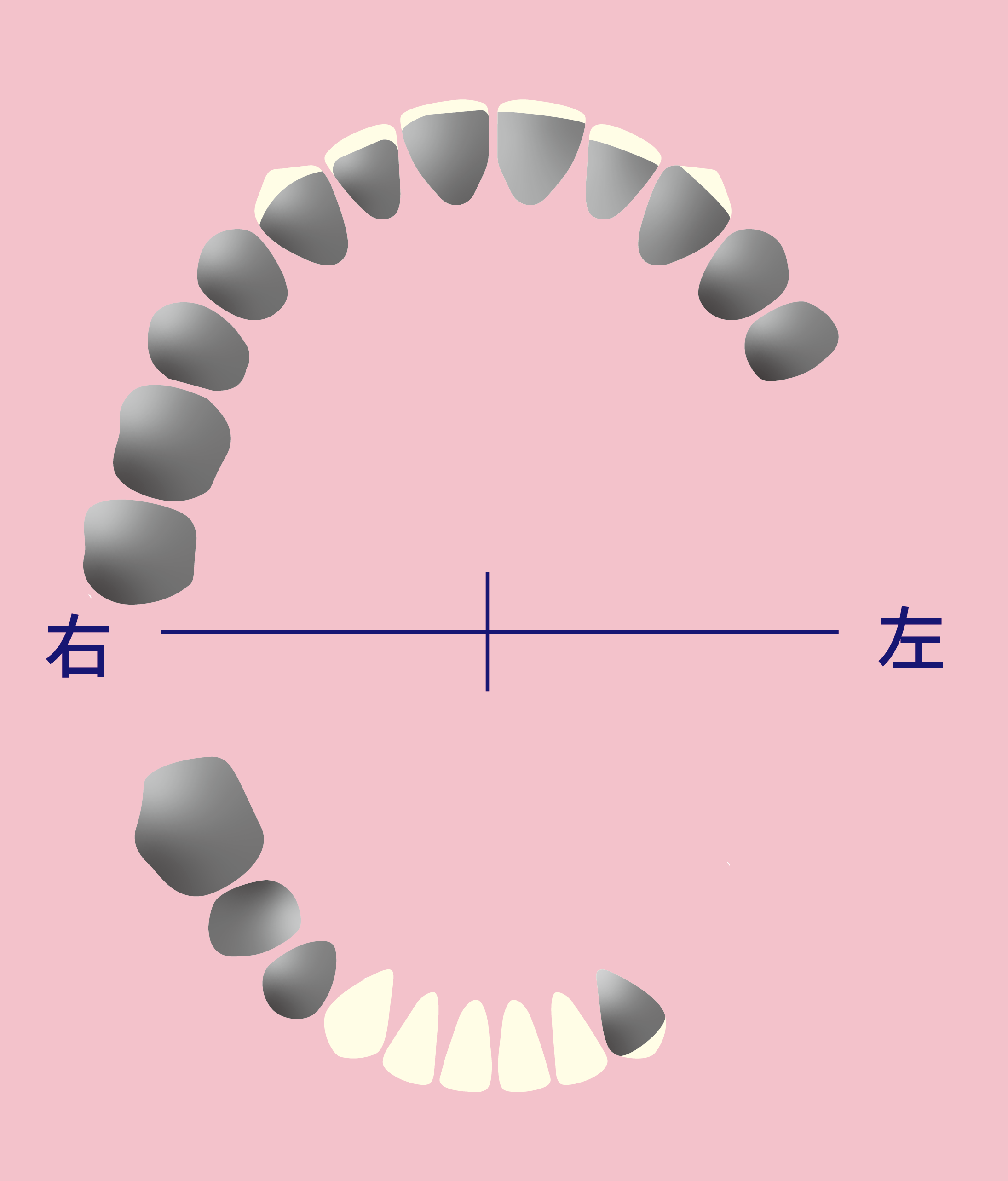 中澤さんビフォーアフターの歯図