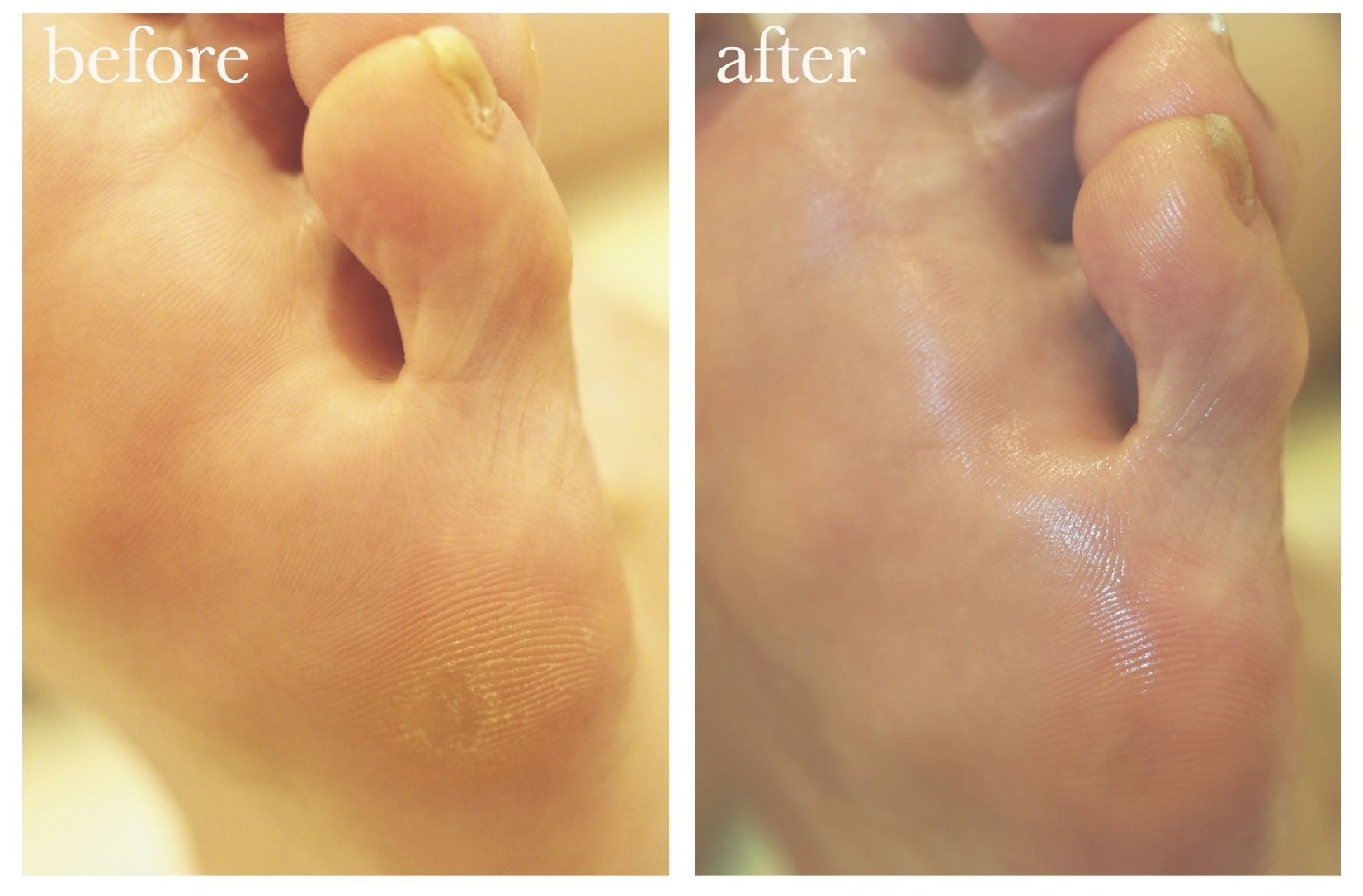 静岡で本格角質フットケア フスフレーゲならアミューネイル 静岡で本格角質フットケア フスフレーゲならアミューネイル