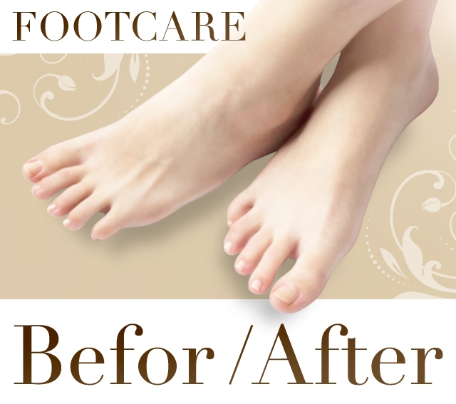 静岡で本格角質フットケア フスフレーゲならアミューネイル 静岡で本格角質フットケア フスフレーゲならアミューネイル