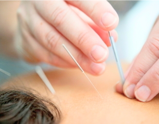 リラックスしながら受けられる鍼治療の様子