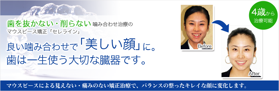 歯を抜かない・削らない　噛み合わせ治療のセレライン矯正歯科