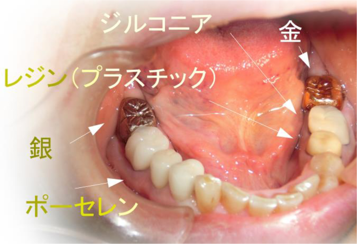 歯科一般 市川市の歯医者なら大門歯科