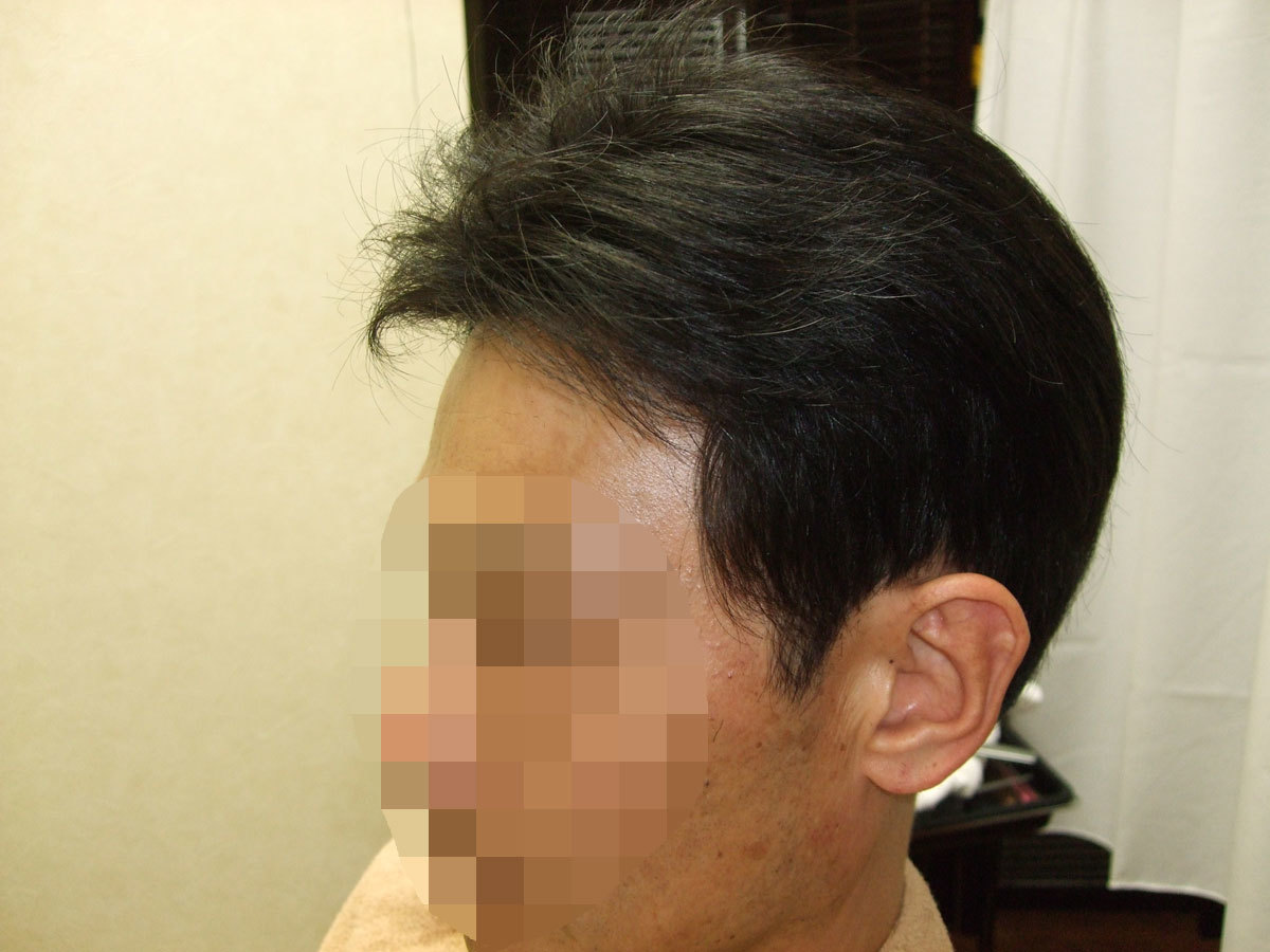 男性用かつら 仙台市のかつら専門店 Victoire ヴィクトワール 男性用かつら 仙台市のかつら専門店 Victoire ヴィクトワール