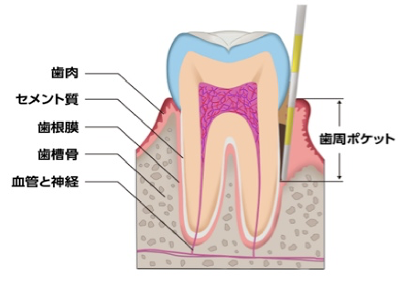歯周病 虫歯治療 life 鎌倉 dental office 鎌倉駅より徒歩5分の歯医者