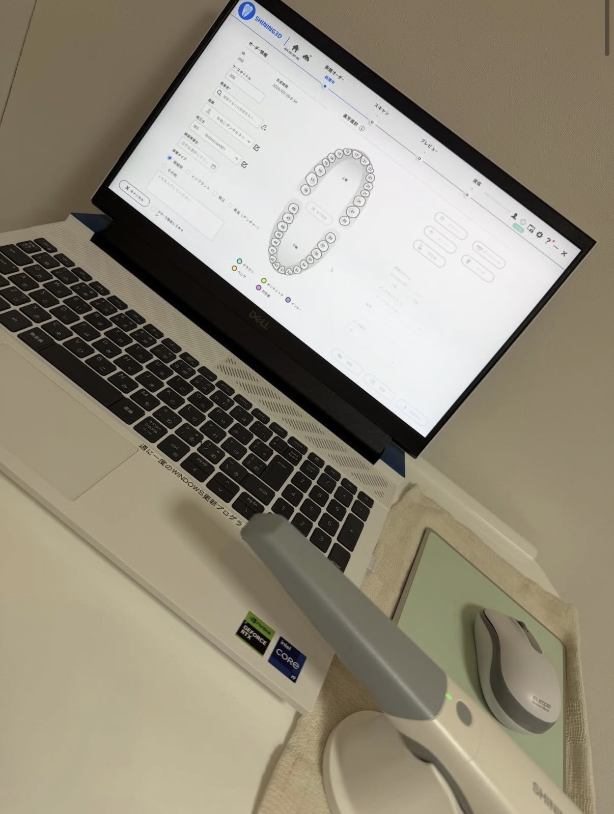 口腔内スキャナー導入しています。
