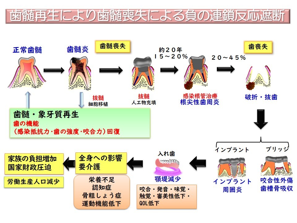Rd歯科クリニック 兵庫県神戸市中央区の歯髄再生治療