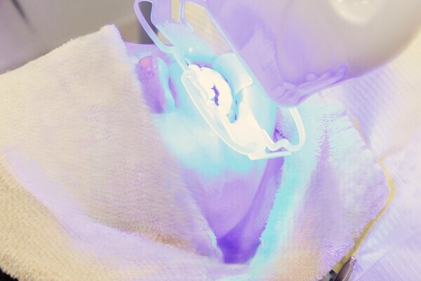 dental_whitening_led_treatment