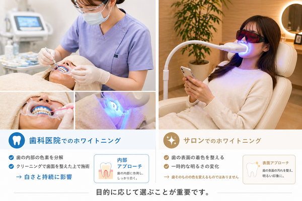 歯科ホワイトニングとサロンホワイトニングの違いを比較した施術イメージ