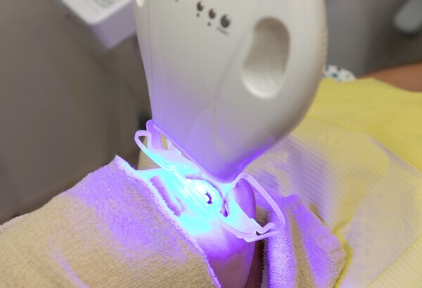 tion-office-whitening-treatment