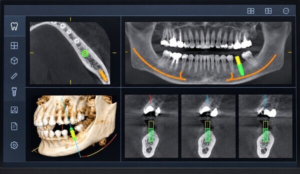 dental-ct-diagnosis-monitor