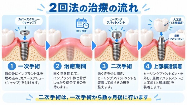 implant-two-stage-treatment-flow