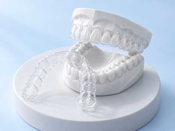 orthodontic_aligner