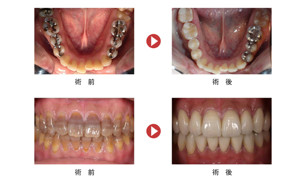 セラミック 福島市の歯医者 カーナデンタルクリニック セラミック 福島市の歯医者 カーナデンタルクリニック
