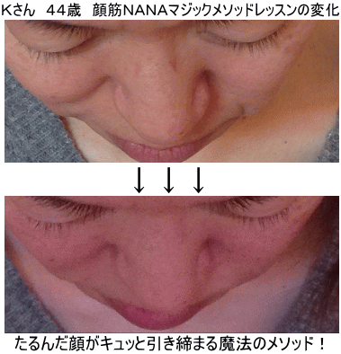 美エイジレス塾 美容整形せずに若返る顔筋nanaメソッド 美エイジレス塾 美容整形せずに若返る顔筋nanaメソッド