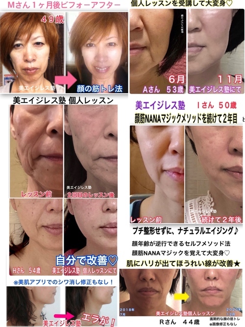 美エイジレス塾 美容整形せずに若返る顔筋nanaメソッド 美エイジレス塾 美容整形せずに若返る顔筋nanaメソッド