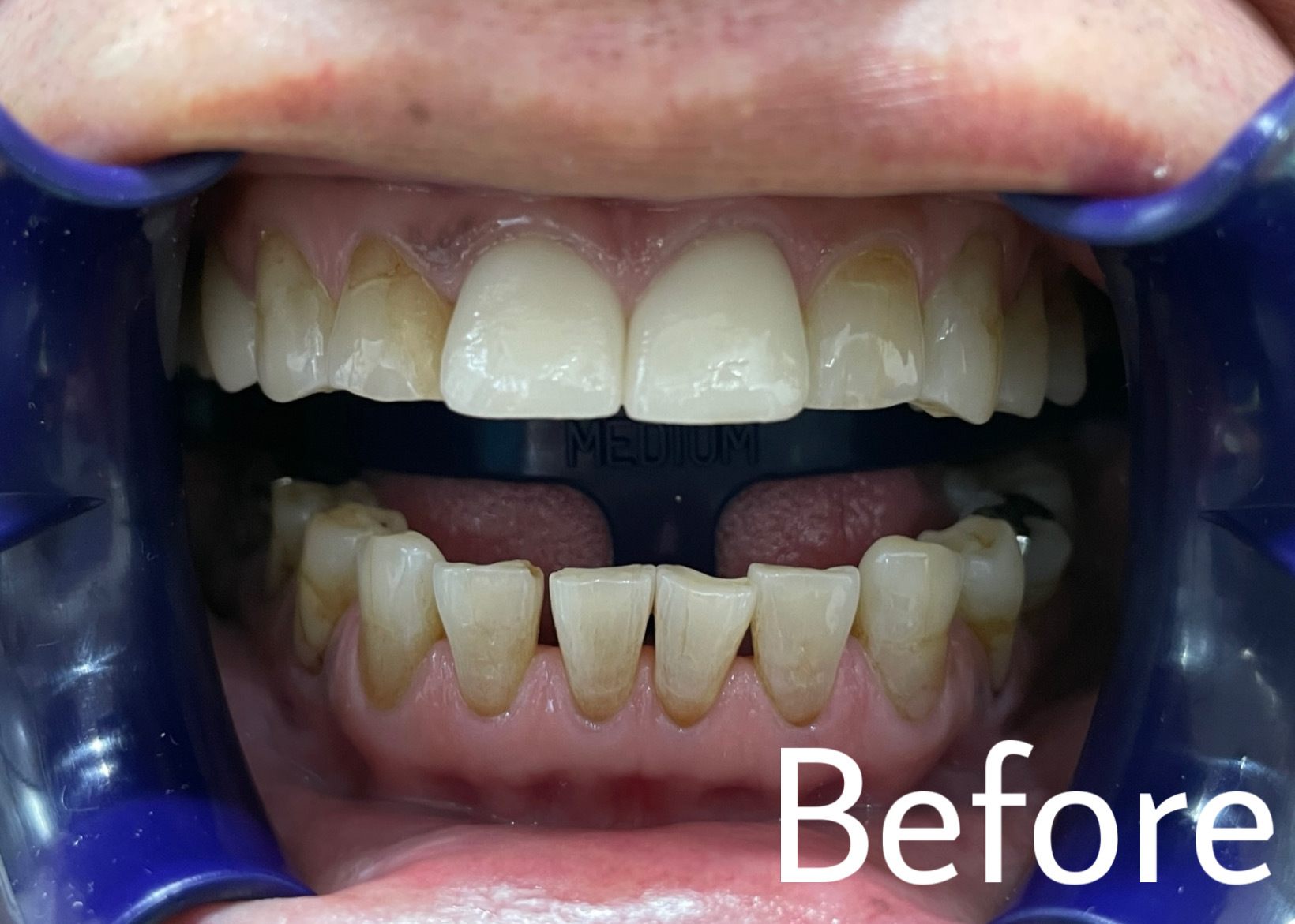 B9DF7E79-1C2B-45B3-8DD4-5316680E3ED8