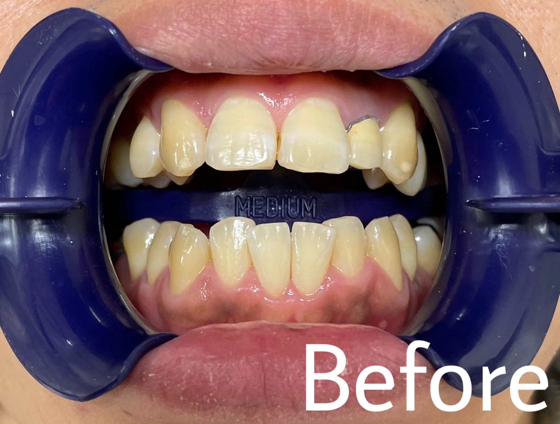 A082FD33-6A6F-4A68-8138-39D0E5B247B1