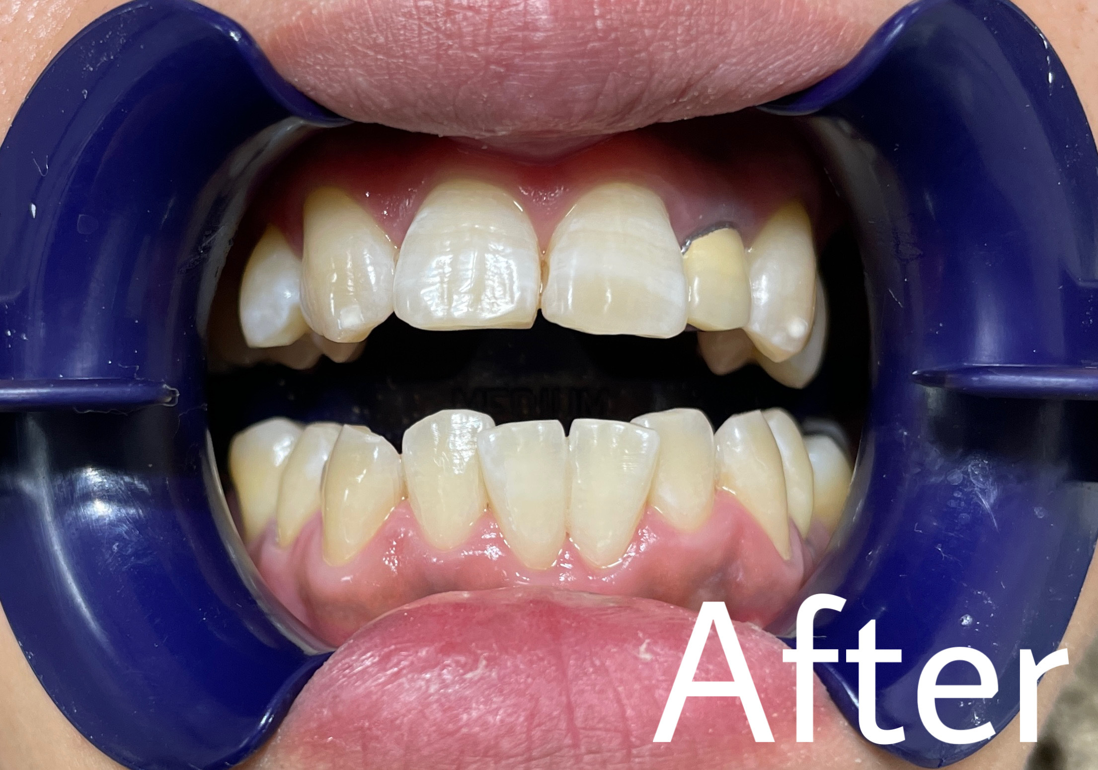 9025EBF0-78AB-4E63-B970-BE13E9CAA74C