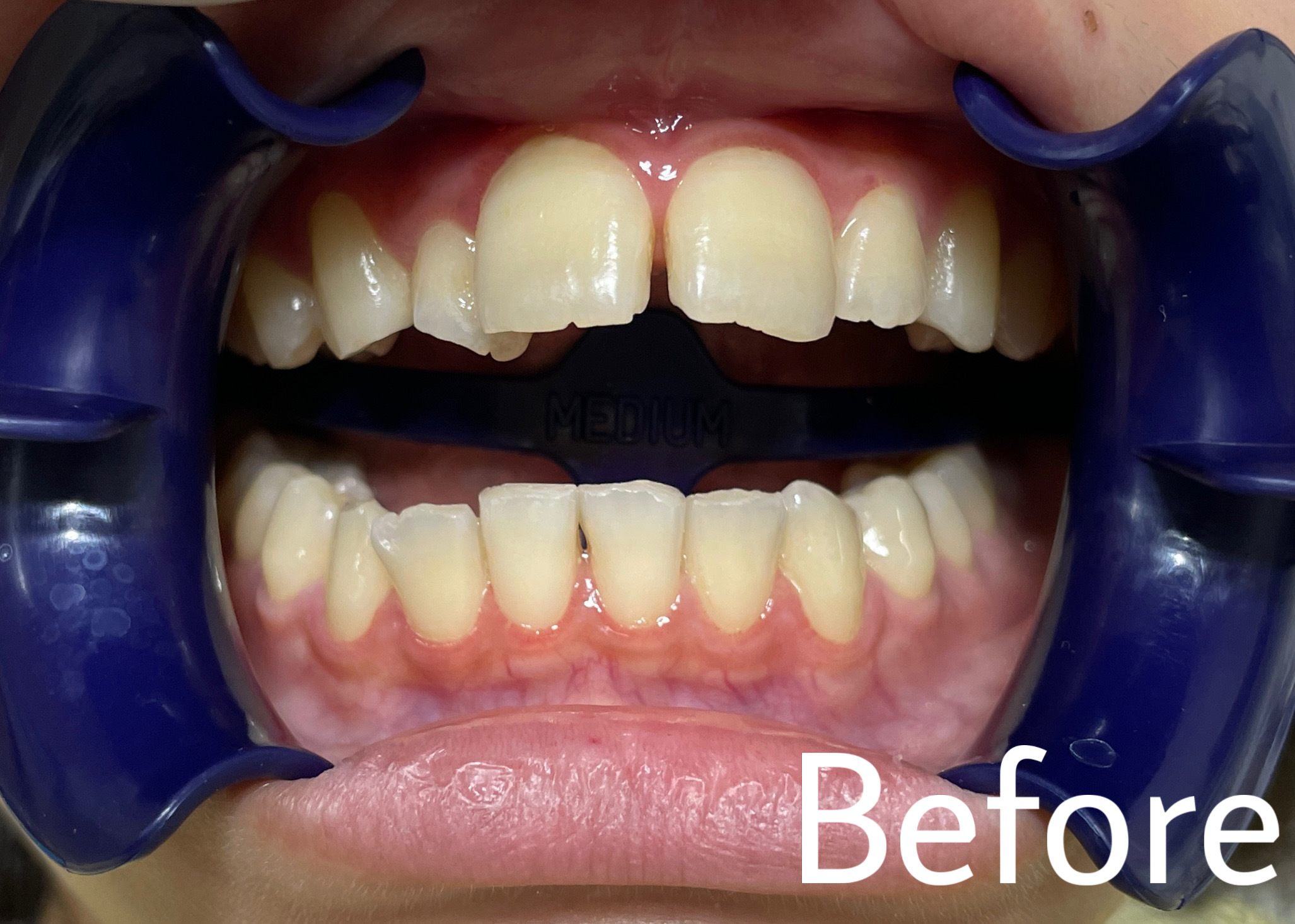 F4C4164A-3737-4ADF-9159-3DC8CBD4493F