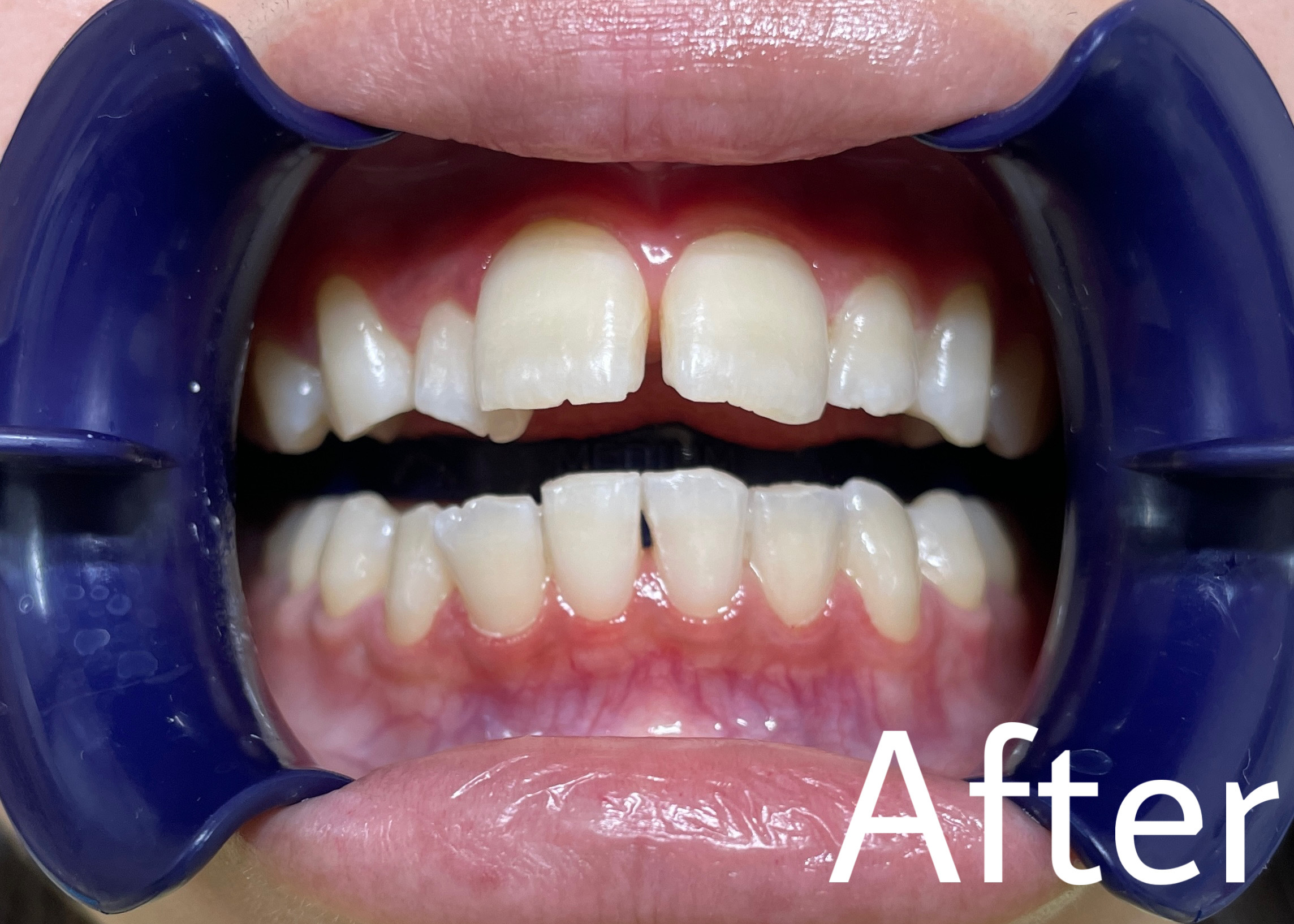 544F25A4-AD15-4B10-9133-3949B0E003D4