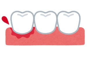ha_shiniku_syukketsu_コピー
