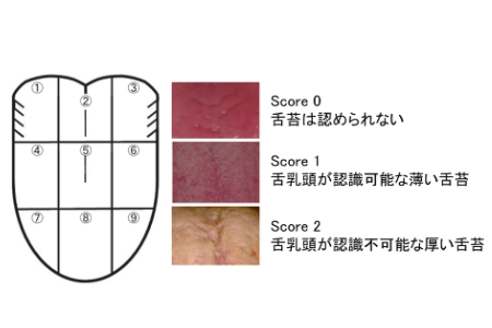 舌苔
