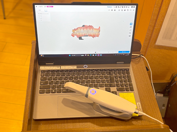 口腔内スキャナー