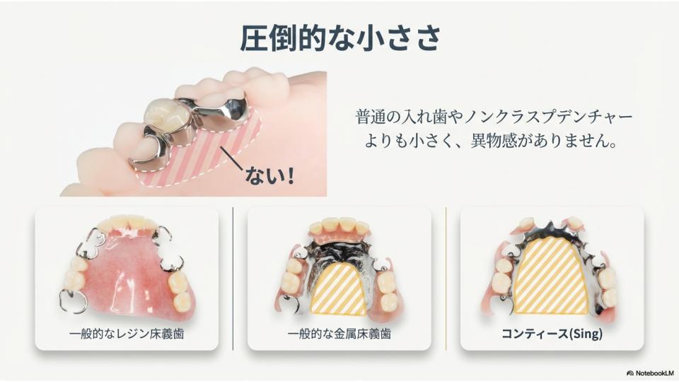 義歯コンサル　部分床　AI (2)
