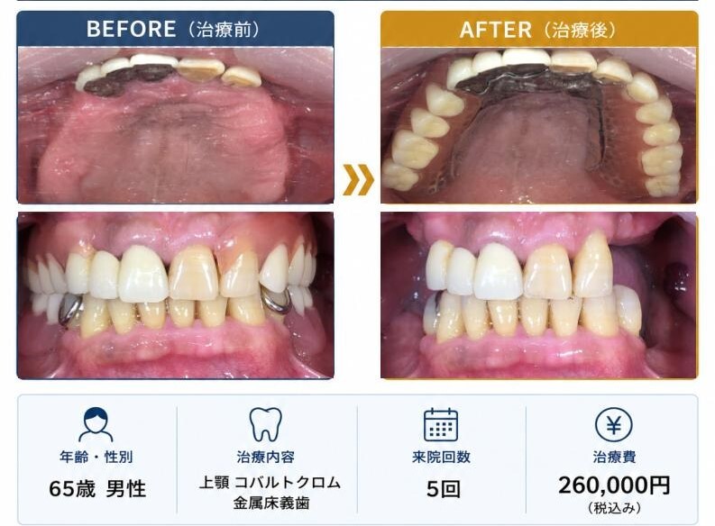 症例写真集 (4)