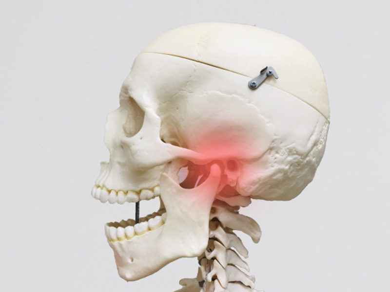 顎関節部分に痛みが生じているイメージの骨格標本の画像